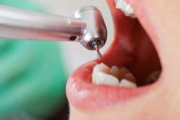 Best Emergency Orthodontic Repairs in Davenport, WA